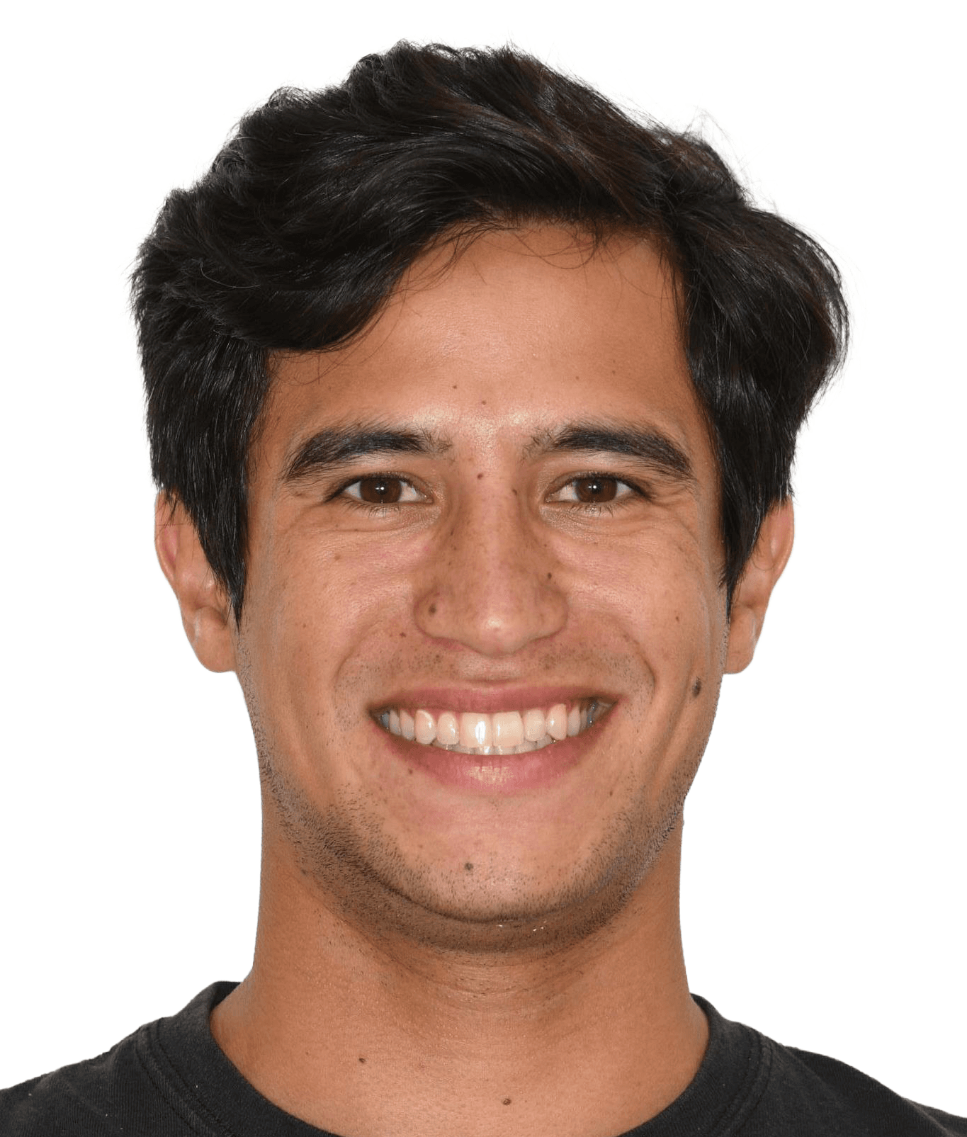 After orthodontic treatment
