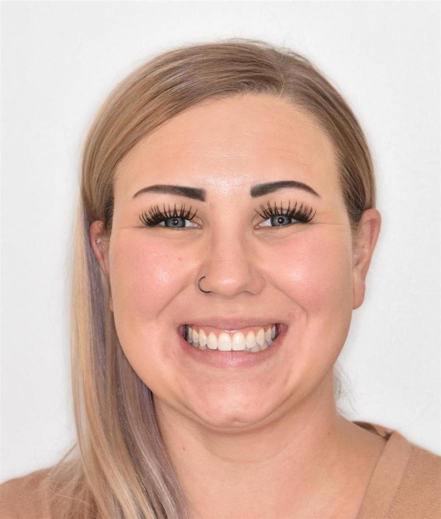 Smiling patient showing beautiful orthodontic results